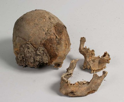 Kranium (Ben), arkeologiskt fynd nummer 79, anläggning nummer 51  i fornlämning RAÄ 143, Spånga socken